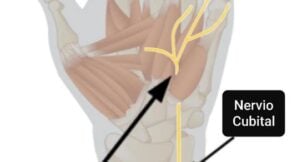 Representación canal de guyon y nervio cubital